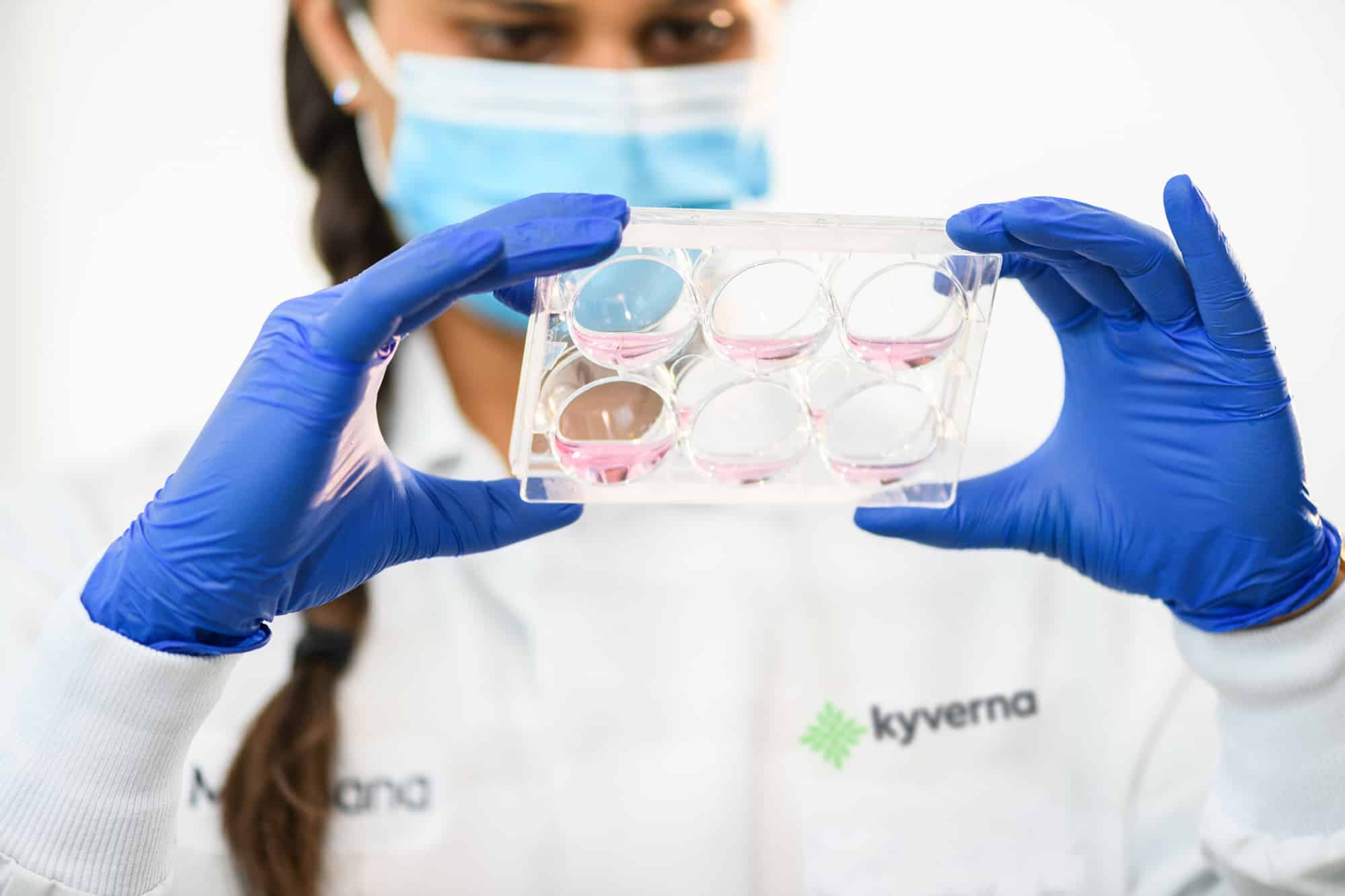 Image for Kyverna Therapeutics Closes $85 Million Series B Financing led by Northpond Ventures 